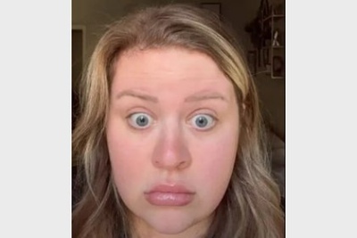 Se le fue la mano con el b&oacute;tox y se le cay&oacute; una ceja