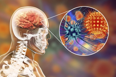 D&iacute;a Mundial de la Meningitis:&iquest;qu&eacute; es y c&oacute;mo se contagia?