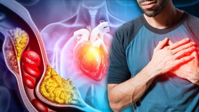 &iquest;Cu&aacute;les son las causas que pueden provocar infartos repentinos en los j&oacute;venes?